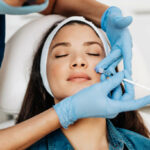 Can Volift Fillers Smooth Deep Smile Lines?