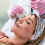 How Long Do RF Micro Needling Results Last?