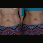 Are Skin Tightening Treatments in Dubai Worth It? Expert Insights and Results
