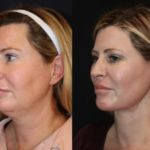 Best Plastic Surgeons in Dubai: What Makes Them Leaders in Skin Tightening Treatments?