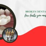 Broken dental crowns – few facts you must be aware about