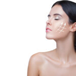 How Nano Thread Lift Delivers Youthful Skin