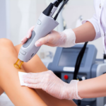 What Makes Electrolysis Hair Removal So Reliable
