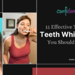 11 Effective Tips for Teeth Whitening You Should Know
