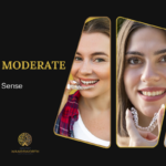 Invisalign Moderate The Middle Ground That Actually Makes Sense