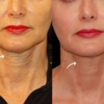 Best Plastic Surgeons in Dubai: Sculptra Trust Signals