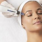 How Dermapen Boosts Skin Healing Process