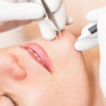Is Electrolysis Laser Hair Removal Worth the Cost