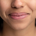 Is Smoker’s Lips Treatment Right for You