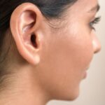 What Makes Otoplasty Results Long Lasting