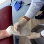 How Physiotherapy Hornchurch Helps Heal Sole Foot Pain Fast
