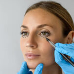 Is Eyelid Surgery Right for Early Signs of Aging?