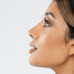 How Does Rhinoplasty Change Your Side Profile?