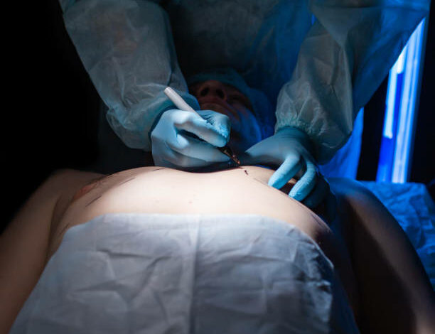 Is Gynecomastia Surgery Painful or Risky Procedure?
