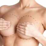 What Age Is Best For Breast Augmentation Surgery?