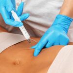 What Areas Can Fat Melting Injections Target