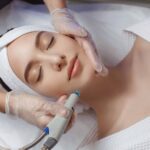 What to Expect From Laser Acne Scar Treatment Results