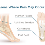 Best Plantar Fasciitis Insoles That Ease Pain, Support Arches, and Improve Posture