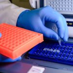How 2D Gel Electrophoresis Improves Resolution?