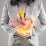Natural Ways to Improve Digestive Motility