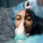 What to Expect After Facelift Surgery?