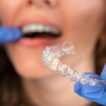 Invisalign treatment – A Clear Path Toward Straighter Teeth