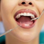 The Essential Guide to Non-Surgical Dental Prophylaxis