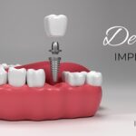 Why Choosing the Right Dentist in Sydney Matters More Now