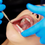 Full Mouth Restoration – Comprehensive Dental Rehabilitation