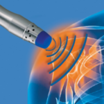 Nerve Compression: Causes, Symptoms, Treatment & Role of Spinal Decompression
