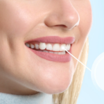 Are Full Mouth Dental Implants Cost Perfect for Total Oral Renewal and Comfort
