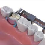 Affordable Dental Equipment Backed by Excellent Service