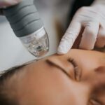 How Soon Do Dermapen Treatment Results Show?
