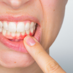 What Is Gum Disease Treatment Louisville KY?