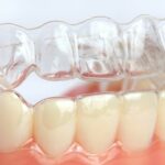 What Is Teeth Whitening West Houston?
