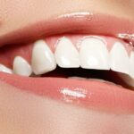 What Is Zoom Teeth Whitening Fairhope AL?