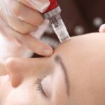 What Makes Skin Rejuvenation Treatments Popular?