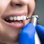 Bright Smiles, Smart Savings: Discover Dental Cleaning Deals & Expert Orthodontics in Elyson, TX