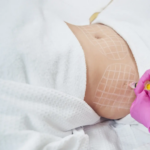 Does Fat Melting Injections Reduce Belly Fat?