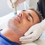 How Safe Is Modern Men’s Laser Hair Removal?