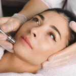 Is Dermapen Treatment Painful or Mild?