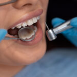 Common Myths About Professional Teeth Whitening Dentists Explained