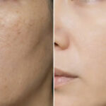 Best Dermatologist Solutions for Skin Discoloration