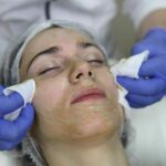 Can Cosmelan Peel Treatment Brighten Uneven Skin Tone Quickly?