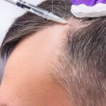 Can G Cell Hair Treatment Stimulate Dormant Follicles?
