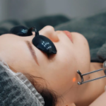 Can Pico Laser Treatment Restore Even Skin Tone Gradually?