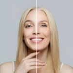 What Areas Can Anti-aging Treatments Improve