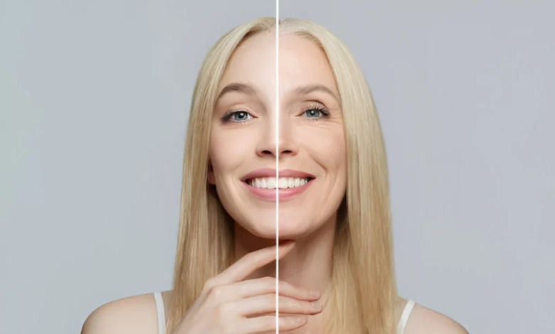 What Areas Can Anti-aging Treatments Improve