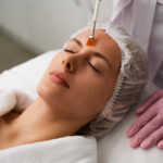 Does Chemical Peel Reduce Wrinkles on Forehead?