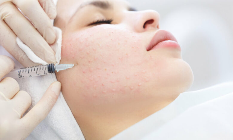 Does Dermal Filler Improve Skin Hydration Levels?